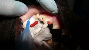 endodoncja3